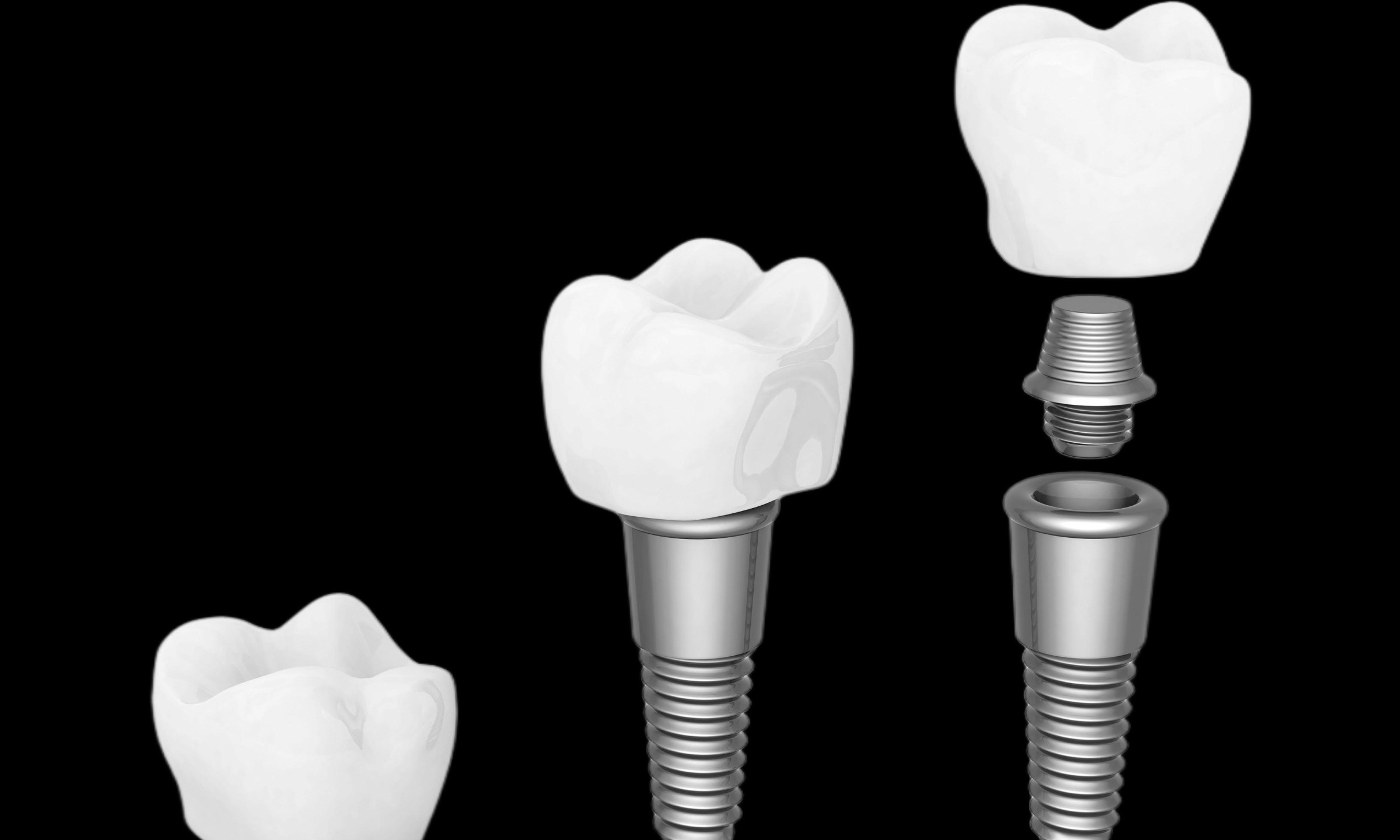 C:\fakepath\Dental Implant.jpg